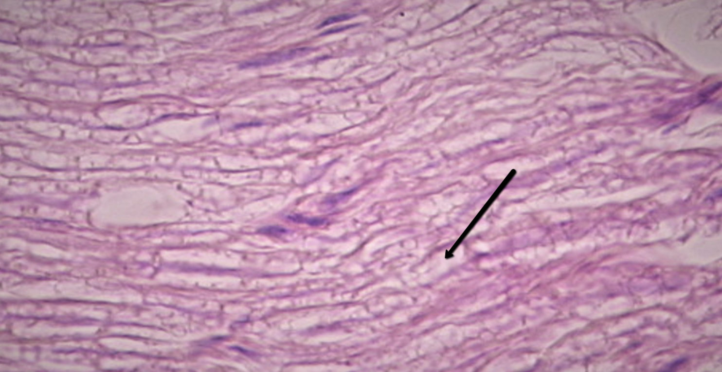 <p><span><strong>Identify the white brick-shaped cell at the tip of the pointer.</strong></span></p>