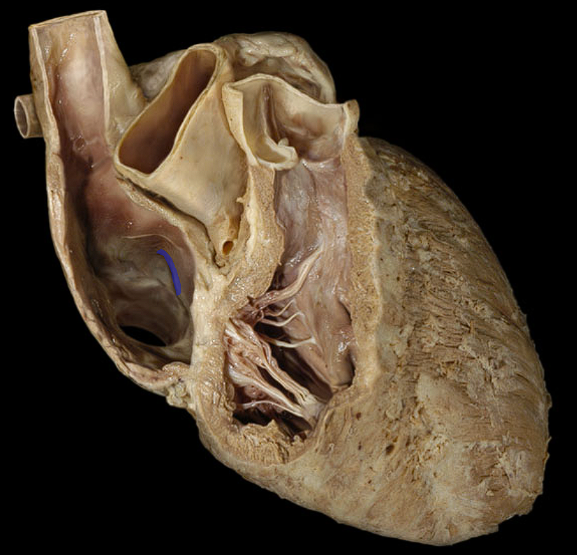 term image