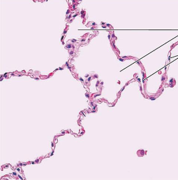 <p>what kind of tissue is this</p>