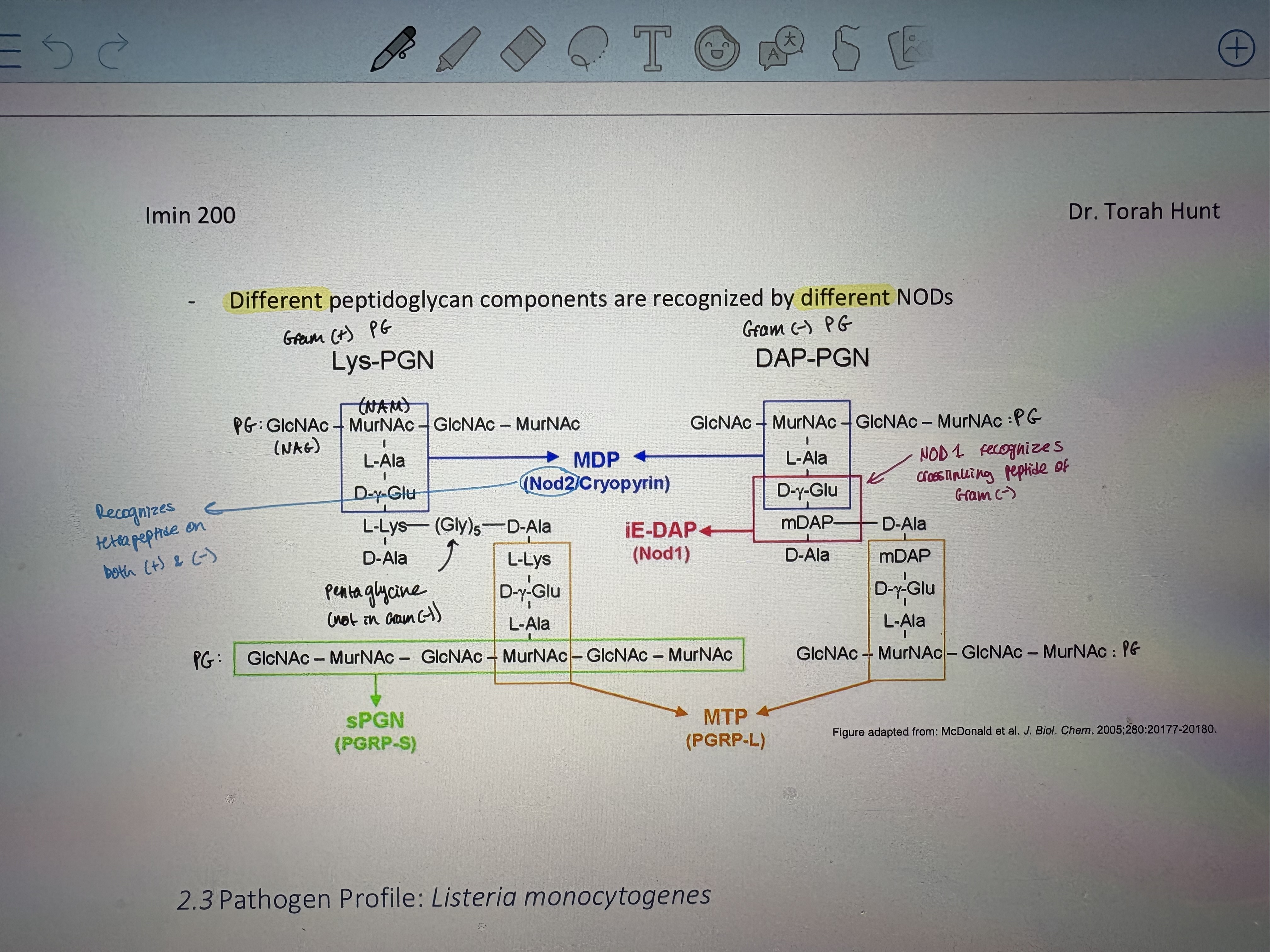 <p>- O-antigen of H. pylori in some strains contain carbohydrates that resemble human Lewis antigens x and y</p><p>- Mimicrky protects from host immune response</p><p>- And – evasion of the NODs</p><p>- Invades stomach lining, but stomach has very good innate immunty from acid</p><p>- secretes a base to neutralize acid which liquifies mucous</p><p>- Motile helical bacteria that swims through liquified mucoud & invades stomach epithelium</p><p>- Modifies Lipid A to aid in evasion </p><ul><li><p>TLR agonist → less virulent. Will activate TLR response </p></li></ul><ol><li><p>Dephosphorylation: reduces (-) charge to decrease sensitivity to AMPs</p></li><li><p>Remove (-) charge on phosphate by adding an amine</p></li><li><p>Removal of 2 acyl chains: hexacylated LPS (6 chains) is highly antigenic therfore removing 2 decreases degree of immune repsonse </p></li></ol><ul><li><p>TLR evasive → virulent. Evades immune system therfore more likley to cause disease </p></li></ul><p></p><p></p>
