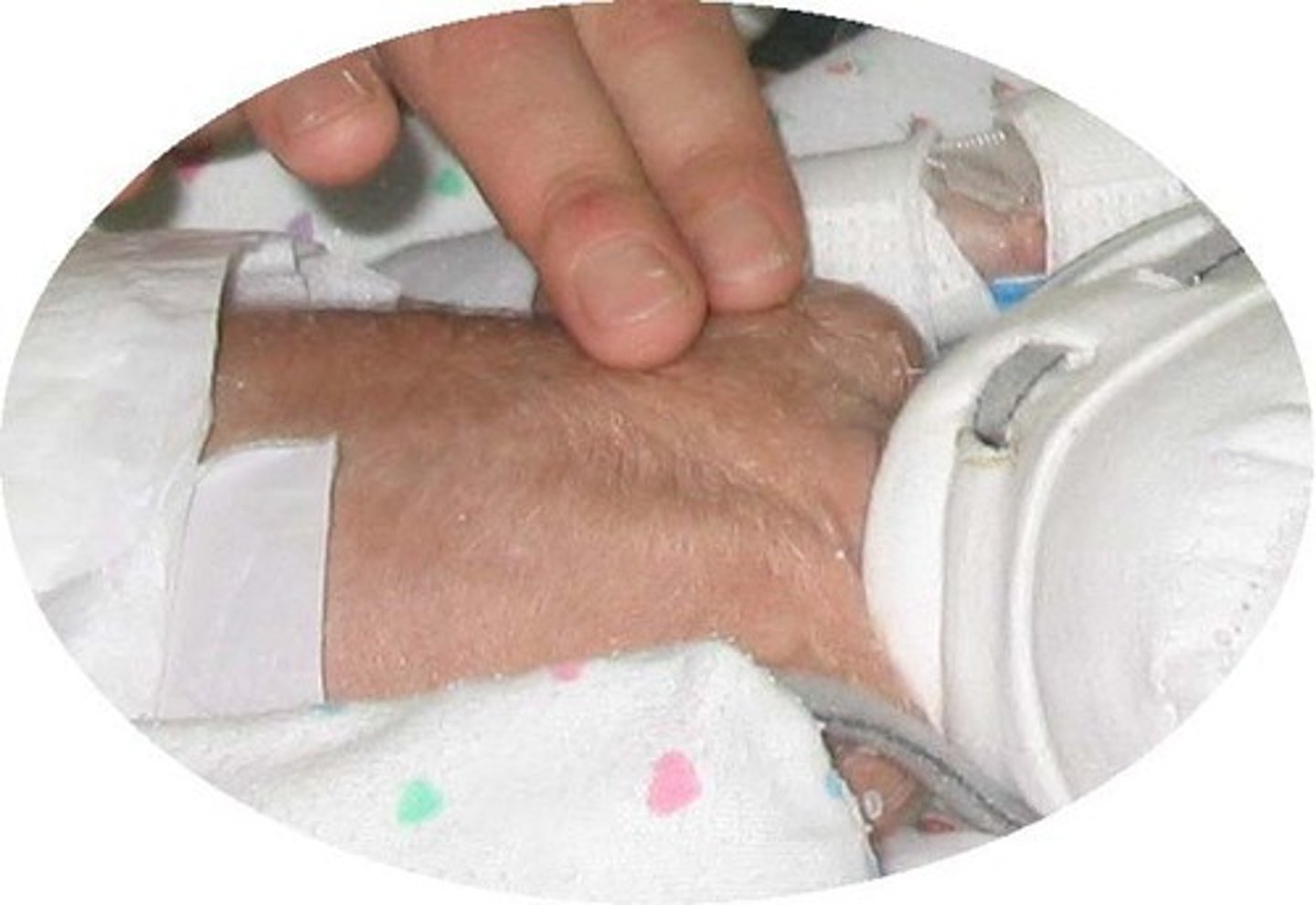 <p>a fine, soft hair that covers a fetus while developing in the womb, often appearing on newborns, especially premature babies</p>