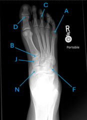 <p>What is A pointing to? (Joint)</p>