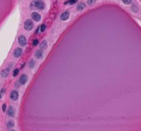 <p>What type of epithelium is shown?</p>