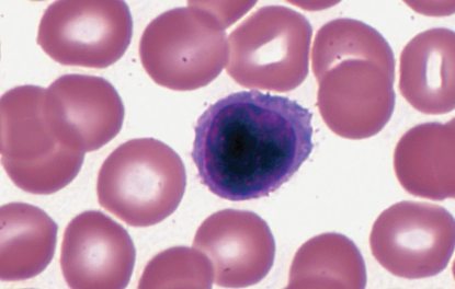 <p>Characteristics of Lymphocyte </p>