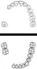 <p>What kennedy classification?</p>