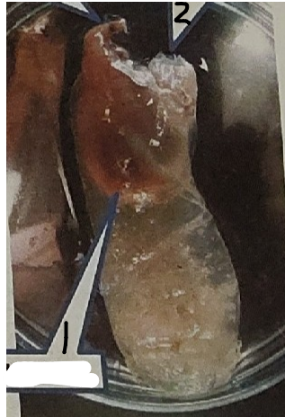 <p>point 1 on this tunicate</p>