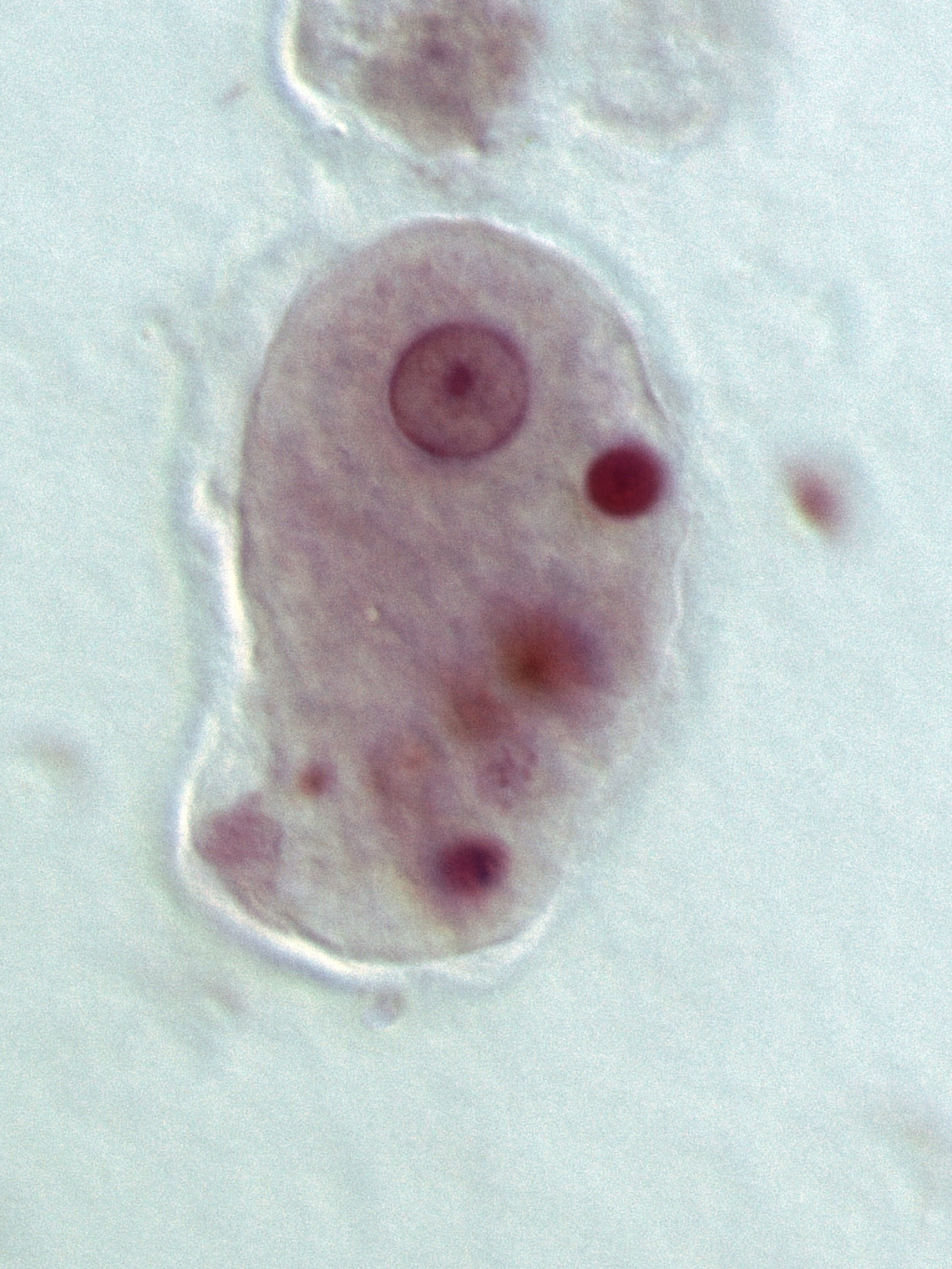 <p>15-25 um, One nucleus with even PC and central karyosome, granular cytoplasm, may have ingested RBCs</p>