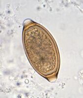 <p>Trichuris campanula or serrate </p>