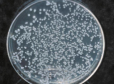 <p>what is this test called, and what is it used for</p>