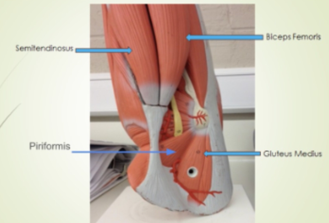 <p><span style="background-color: transparent; font-family: "Times New Roman", serif;">Biceps Femoris, Gluteus Medius, Piriformis, Semitendinosus</span></p>
