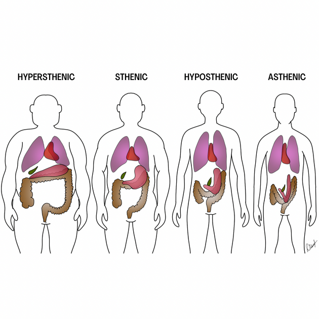 <p>Hypersthenic</p>