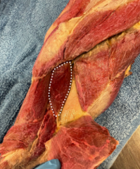 <p>Identify the muscle</p>
