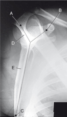 <p>C?</p>