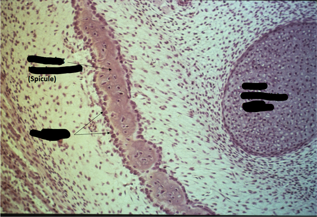 <p>developing membrane bone</p>
