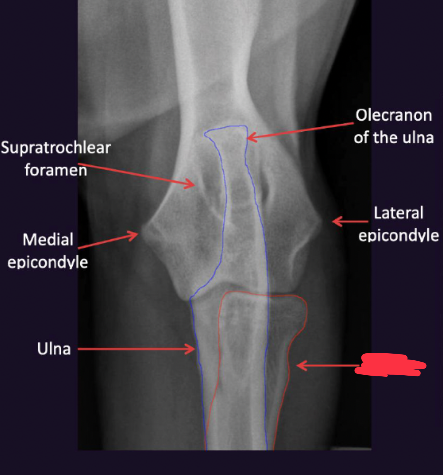 term image