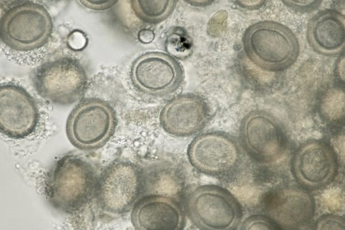 <p>What parasitic worm is this?</p>