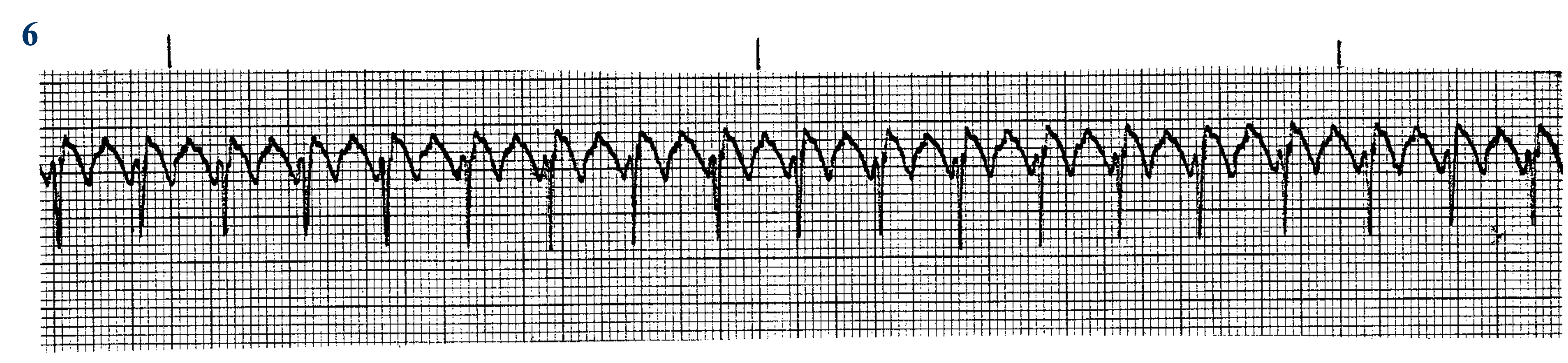 <p>What is this ECG? </p>