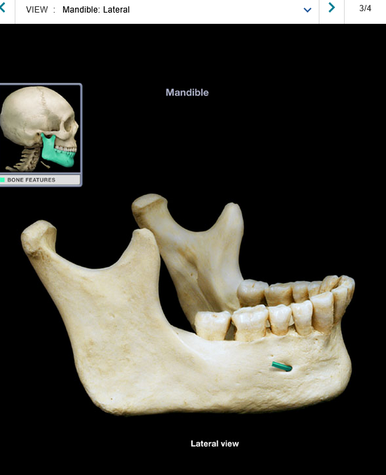 <p>Mental foramen</p>