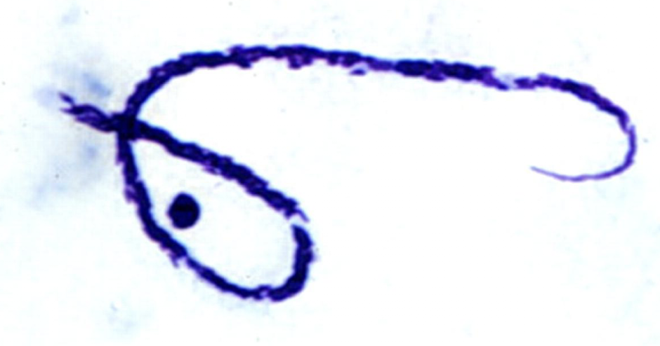 <p>What parasite is this?</p>