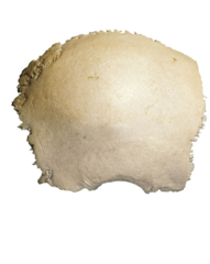 <p>What structure is this?</p>