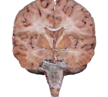 <ul><li><p>divides the body intoventral/anterior and dorsal/posterior</p></li></ul><p>• longitudinal plane perpendicular to thetransverse plane</p><p></p>