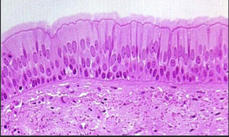 <p>What tissue is this? and where can you find it?</p>