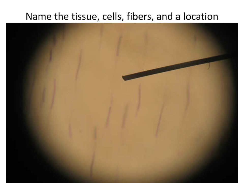 <p>Name of tissue?</p>