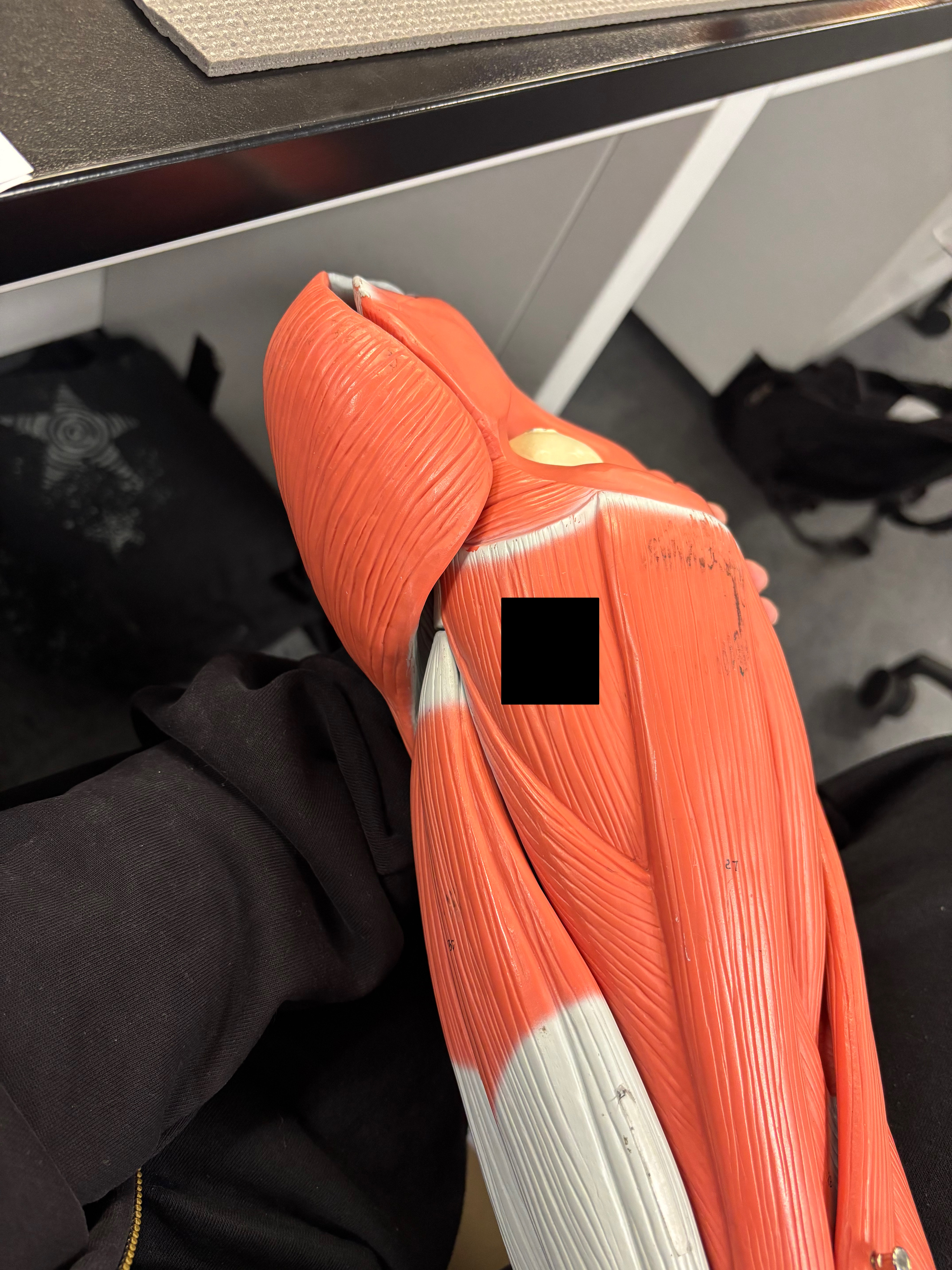 <p>What muscle is this and what is its action?</p>
