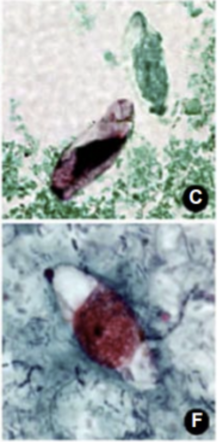 <p>-Oocysts 4-6 um (slightly smaller than RBC)</p>