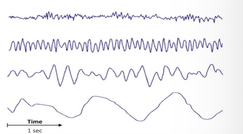 <p>Beta, Alpha, Theta, Delta</p>