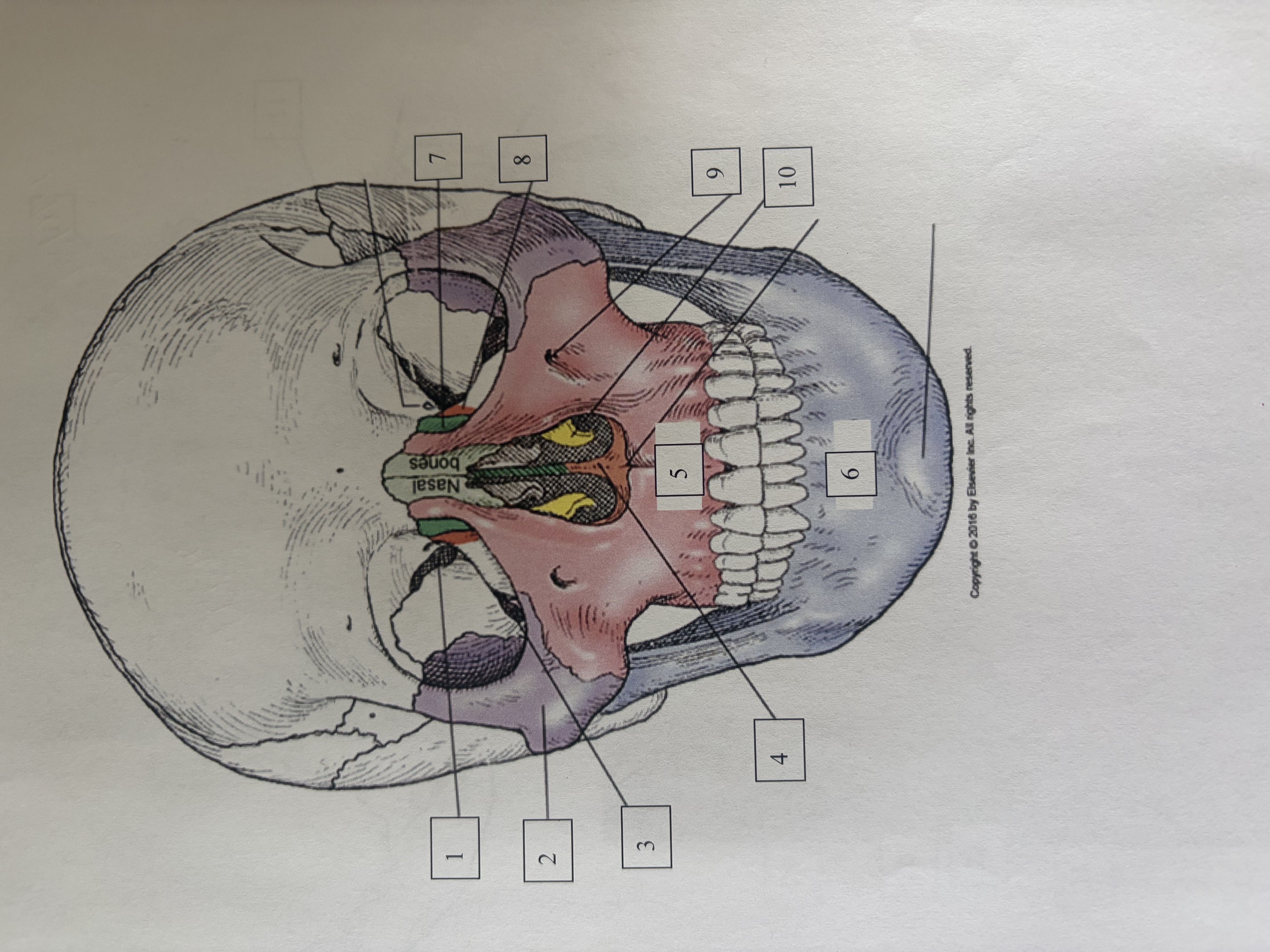 <p>superior orbital fissure </p>
