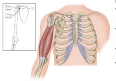 <p>What muscle is highlighted?</p>