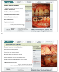 <p>Contraindication</p>