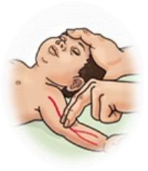<p>Brachial Artery</p>