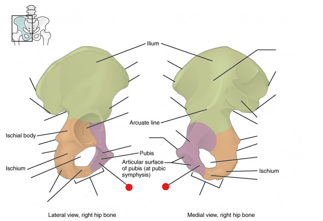 <p>Identify the structure pinned</p>