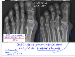 <p>CBC, uric acid levels and maybe an ESR</p>