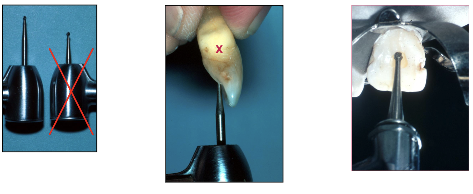 <p>use surgical bur #2 (NOT short) to follow the long axis of the tooth </p>