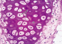 <p>What type of cartilage is shown?</p>