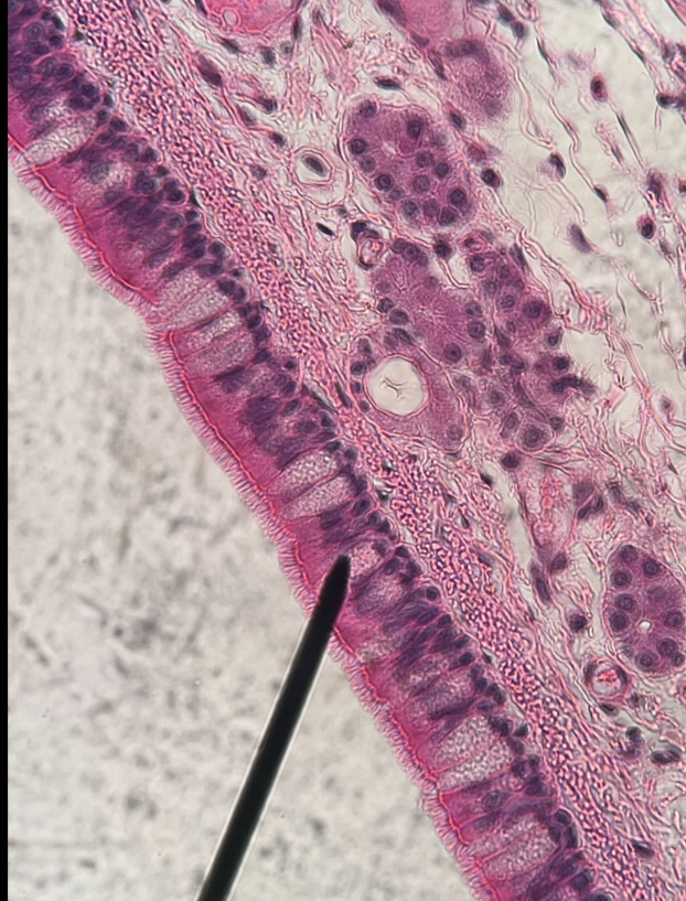 <p>ID tissue</p>