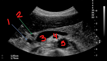 <p>Identify this image.</p>