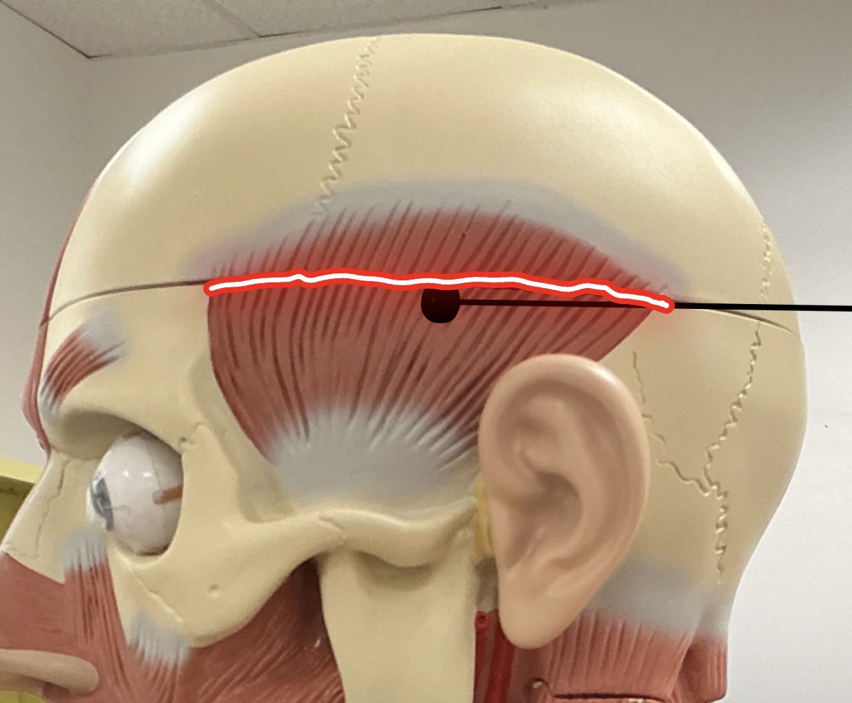 <p>Temporalis</p><p>Origin:</p><p>Insertion:</p>