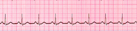 <p>what waveform is this </p>