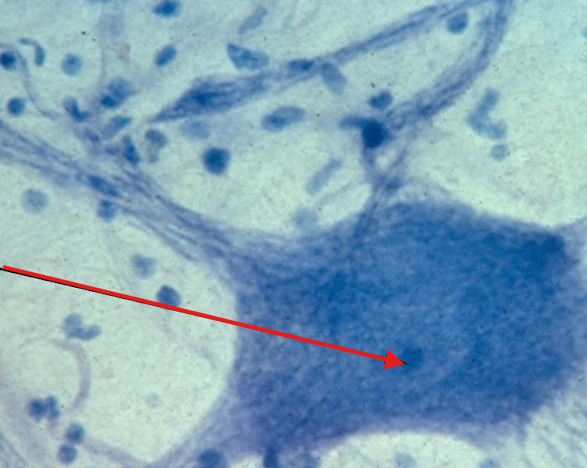 <p>Multipolar neuron 400x</p>
