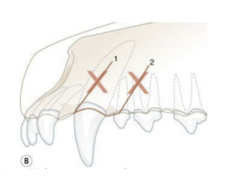 <p>Is this the correct placement of releasing incisions for a flap design? If not, explain why. </p>