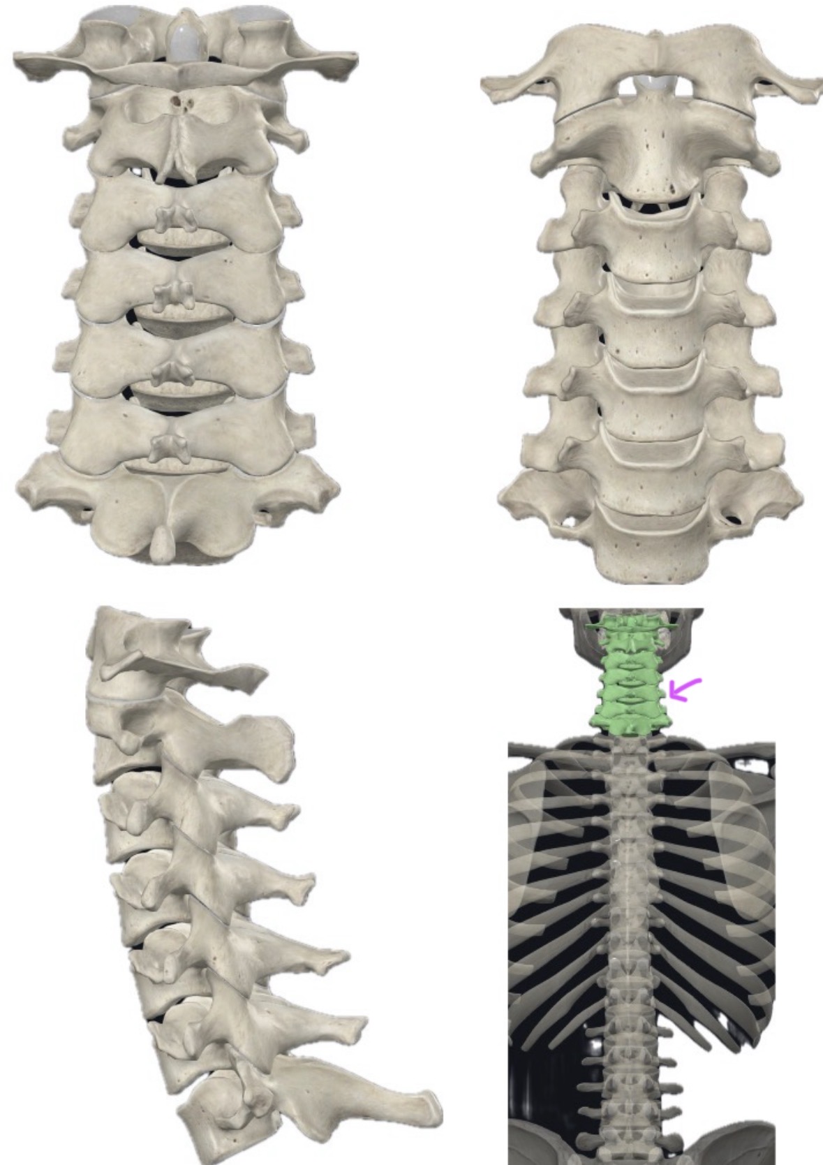 <p>What bone is this?</p>