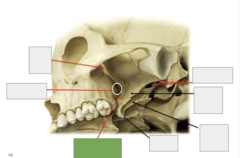 <p>Inferolateral view: This is the</p>