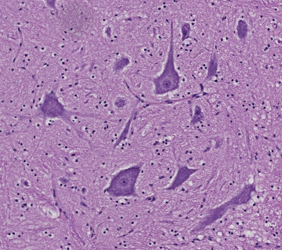 <p>what is the anatomical classification of the motor neurons in the ventral horn? what do these somatic motor neurons innervate?</p>