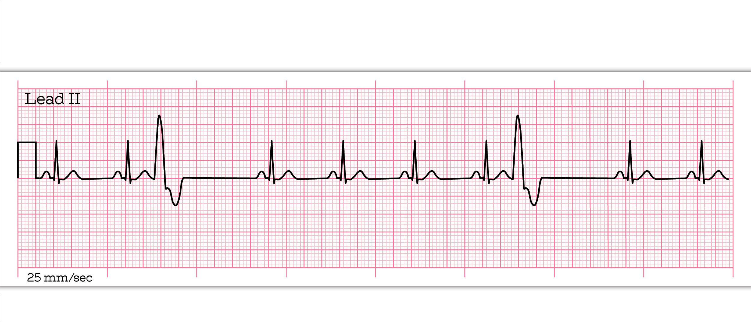 <p>What rhythm is this?</p>