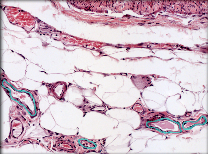 <ul><li><p><strong>Location: </strong>Middle layer of vessel wall</p></li><li><p><strong>Function: </strong>Vasoconstriction and vasodilation (when muscular tunica media present)</p></li><li><p><strong>Description:</strong></p><ul><li><p>Small venules lack tunica media</p></li><li><p>Larger venules acquire incomplete tunica media of smooth muscle</p></li></ul></li><li><p><strong>Comment: </strong>In arteries, tunica media is thickest layer; in veins, tunica externa is thickest layer</p></li></ul><p></p>