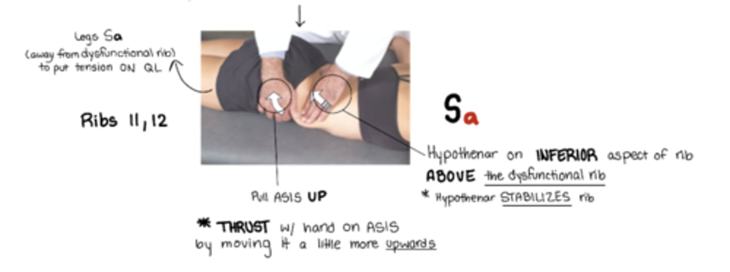 <p>exhalation sd</p><p>Sa = legs away from dysfunctional rib</p><p>stand OPPOSITE of dysfunctional rib</p><p>active hand: hand pulls UP on ASIS to push rib back down</p><p>other hand: hypothenar eminence on inferior aspect of rib ABOVE dysfunctional rib to stabilize rib</p><p>ribs stuck UP</p>
